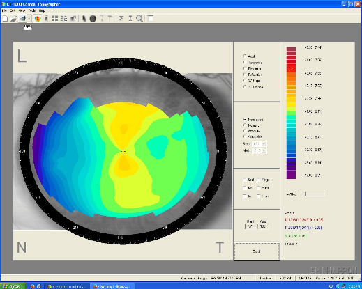Кератотопография OS